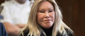 Wie diese Frau vor der Schönheitsoperation aussah