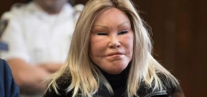 Wie diese Frau vor der Schönheitsoperation aussah
