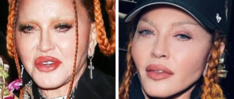 „Nicht mehr aufgedunsen, ich bin attraktiv!“  Madonna zeigte ihr Gesicht nach Schönheitsoperation