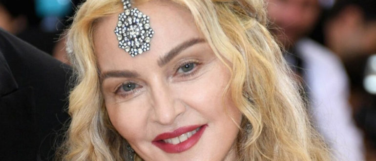 Ich habe die Hälfte meines Gesichts und meiner Wangen verloren!  Fans erkennen die Sängerin Madonna nicht mehr