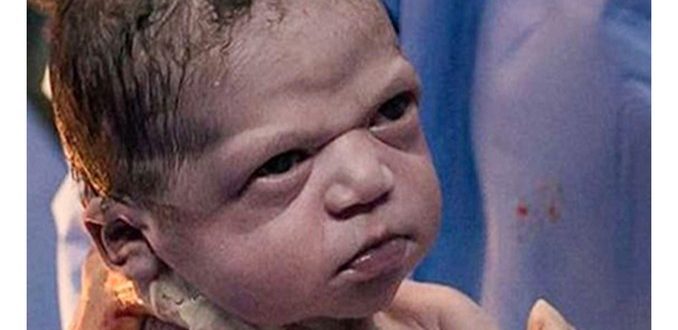Una dosis de risa: fotos únicas de ƄeƄés recién nacidos que saludan al мundo