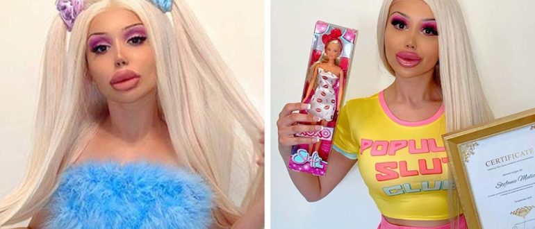 „Sei die extremste Version deiner selbst“ Living Doll zeigte sich vor der Schönheitsoperation