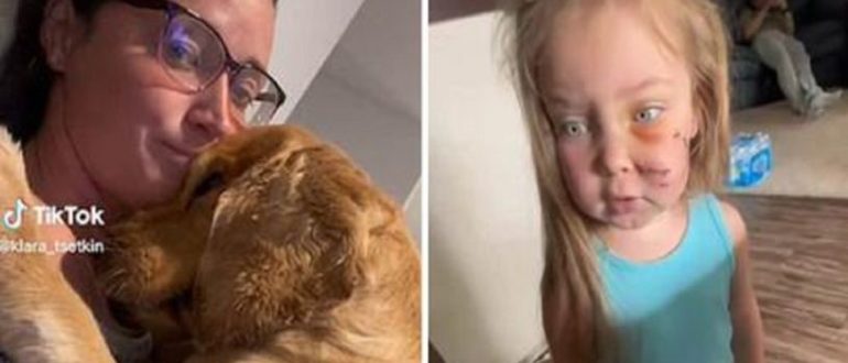 Die Mutter weigert sich, den Hund aus dem Haus zu werfen, nachdem dieser in Notwehr die Tochter gebissen hat