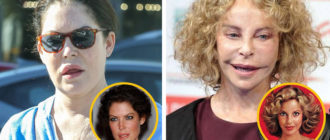 The Wrong Turn: Stars, die ihre Karriere wegen plastischer Chirurgie ruiniert haben