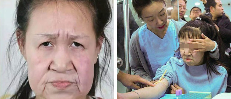 Wie war das Leben von Xiao Feng, einer Chinesin, die mit 15 Jahren wie eine alte Frau aussah?
