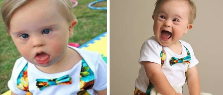 „Das zurückgewiesene Baby wurde populär“: Die Modelagentur lehnte dieses Baby ab, weil es das Down-Syndrom hatte