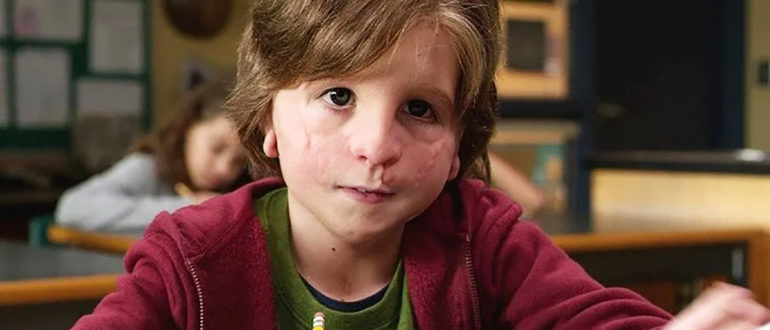„Es ist unmöglich, ihn ohne Make-up zu erkennen“: Wie sieht der Schauspieler, der den Jungen Oggy im Film „Miracle“ spielte, heute aus?